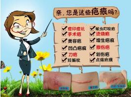 长沙疤痕修复医院哪家好